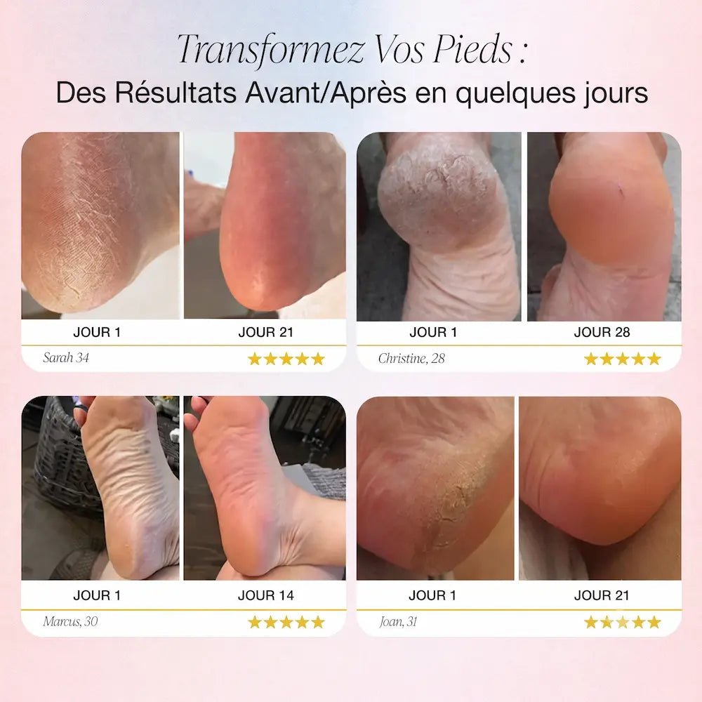 Solav Lissea — Râpe électrique anti-callosités