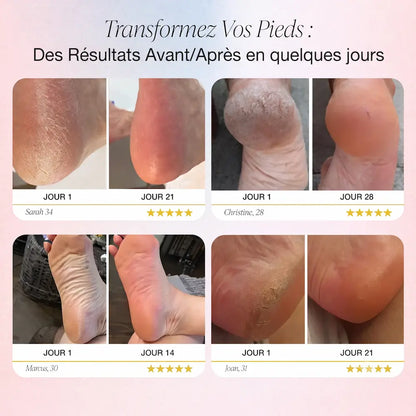 Solav Lissea — Râpe électrique anti-callosités